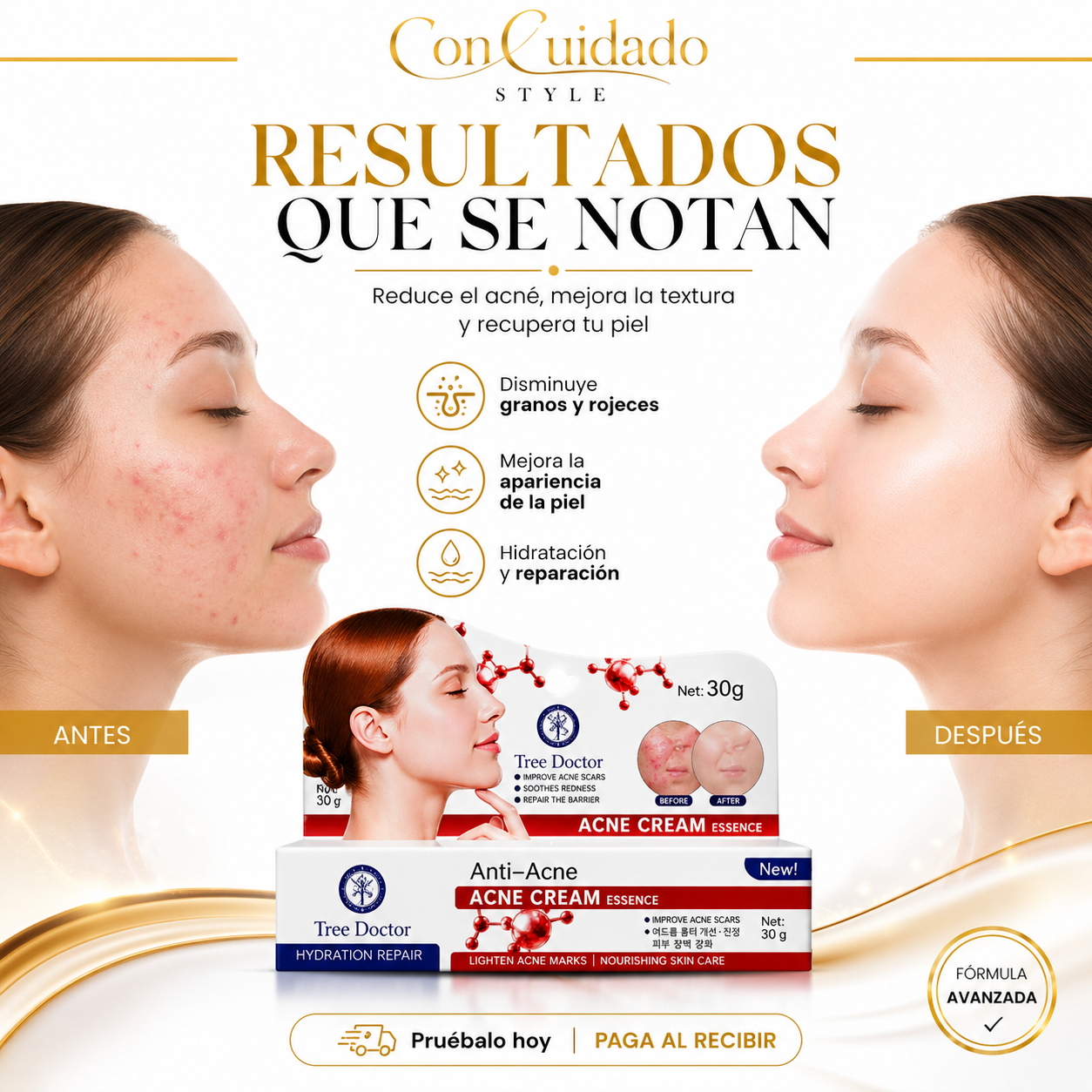 Crema ANTI ACNE